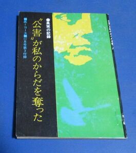 Y77)高1コース付録　真実の記録　公害が私のからだを奪った　昭和44年　水俣病、スモン病、四日市ぜんそく