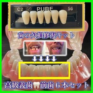 正規品 （前歯下段６本）歯科人工歯 歯の欠損修復 高品質樹脂製 高級義歯全６個セット 義歯 仮歯 付け歯 入れ歯 インスタントスマイル BX