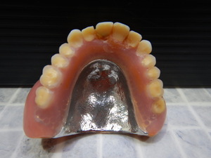 #245　歯科 総義歯　メタル 金属床 フルデンチャー 入れ歯　34g　補綴/サンプル/模型/インプラント/総入れ歯