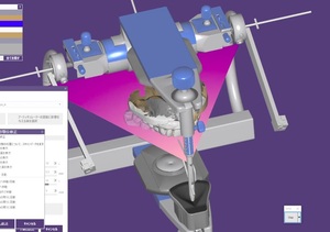 歯科　歯科用　デジタルフェイスボウ デジタルマウント　試作品　プロトタイプ　mp4動画　stlパーツ