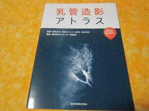 乳管造影アトラス　乳管腺葉区域切除術WEB動画付き　２０２１年出版のアトラスです（乳腺科　医学本　他）