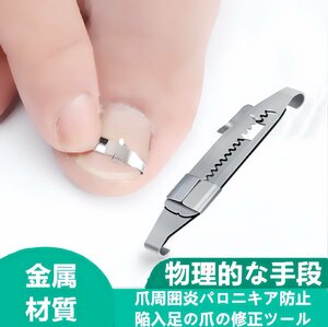 巻き爪ケアクリップ ワイヤー ガード 爪ブロック テープ 巻きづめ 治し方　矯正　テープ 巻きづめ 靴 巻爪 対策 足の巻き爪 防止