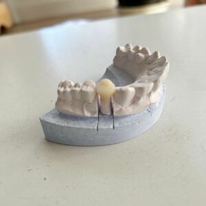 CAD/CAM サンプル　歯科模型
