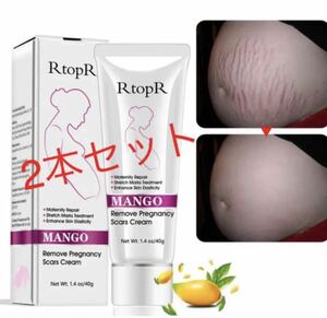 【2本】 RtopR マンゴー 妊娠線予防クリーム　ストレッチマーククリーム