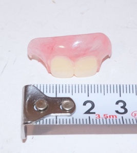 歯科 義歯 スマイルデンチャー ノンクラスプデンチャー サンプル 模型 見本 入れ歯 補綴 デンチャー 説明 技工 自費 資料 3