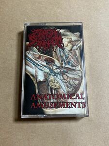 カセットテープ CRASH SYNDROM / ANATOMICAL AMUSEMENTS : OBLITERATION RECORDS