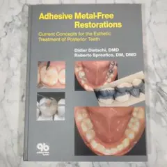 【極美品】Adhesive Metal-Free Restorations