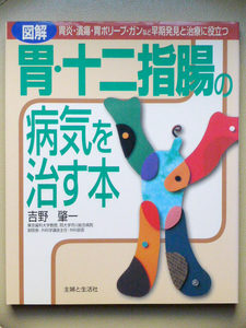 ●○図解 胃・十二指腸の病気を治す本　吉野肇一　主婦と生活社○●胃炎 胃がん 胃潰瘍 十二指腸潰瘍 ポリープ 内視鏡 腹腔鏡 放射線