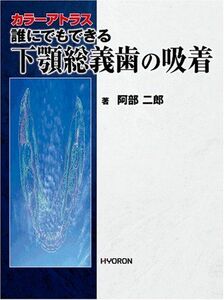 [A11240165]誰にでもできる下顎総義歯の吸着