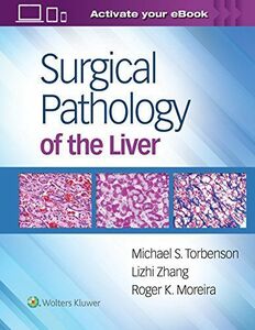 [A11743277]Surgical Pathology of the Liver [ハードカバー] Torbenson MD， Michael、