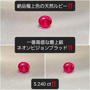 7.5万円スタート！『 5.240ct！ 』物凄い発色！一番高価な最上級ネオンピジョンブラッド！極上天然ルビー！