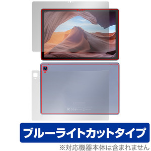 VANKYO MatrixPad S31X 表面 背面 フィルム セット OverLay Eye Protector ヴァンキョウ マトリックスパッド ブルーライトカット