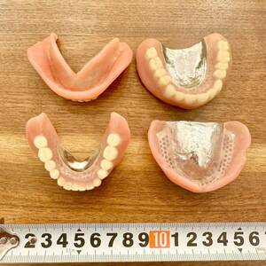 入れ歯 歯科金属 コバルトクロム床 チタン床 義歯 総入れ歯 上下 2セットレアメタル 歯科技工 歯科材料 金属床義歯