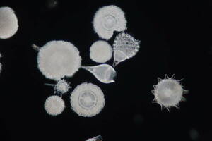 希少 バルバドス (Barbados) 島産 放散虫 (Radiolaria) 大型カバーグラス L009 プレパラート顕微鏡標本 微化石 微生物 プランクトン 