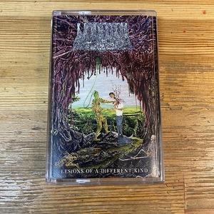 【期間限定30%OFFセール！】UNDEATH / LESIONS OF A DIFFERENT KIND (ミュージックテープ)