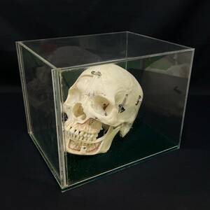BDg158R 80 頭蓋骨 模型 分解模型 標本 医学 医療 資料 歯科 クリアケース付 骸骨 ガイコツ スカル デッサン アンティーク 美術