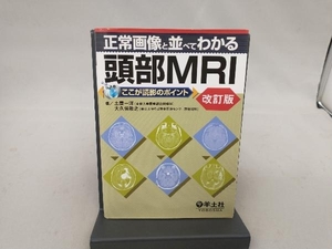 正常画像と並べてわかる頭部MRI ここが読影のポイント 改訂 土屋一洋